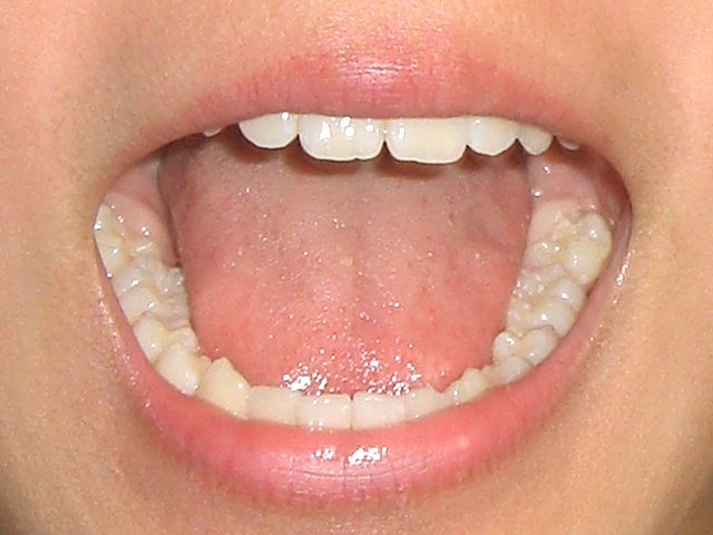 中村歯科コラム：キレイな歯並び